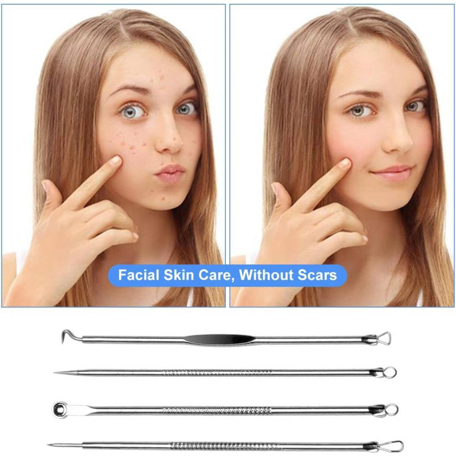 LEKADOL Acne Needle Set Blackhead Pimple Acne Whitehead Removal Needle Kit Acne Treatment Tool, Stainless Steel, 4Pcs, B23001