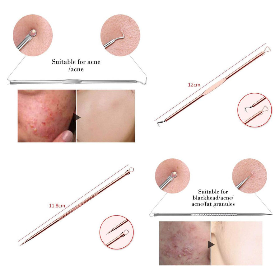 Blackhead Remover Pimple Comedone Extractor Tool Best Acne Removal Kit - Treatment for Blemish, Whitehead Popping, Zit Removing for Risk Free Nose Face Skin with Case (Rose, 4 Piece Set)