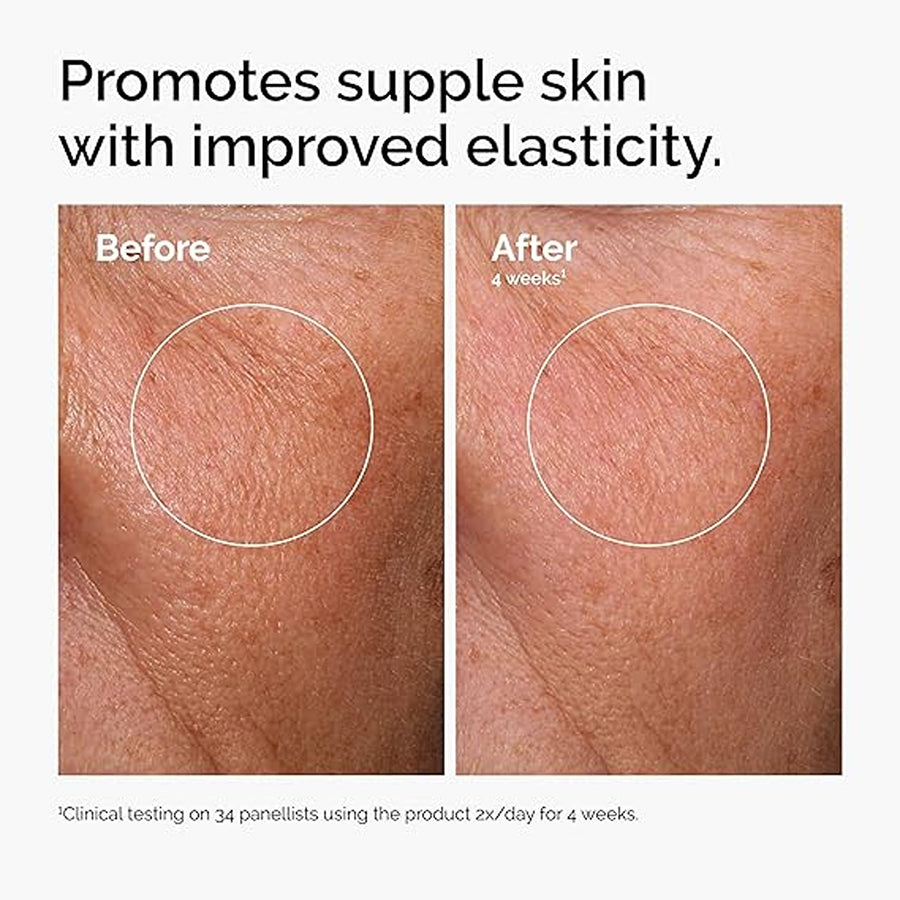 Hyaluronic acid2% +b5