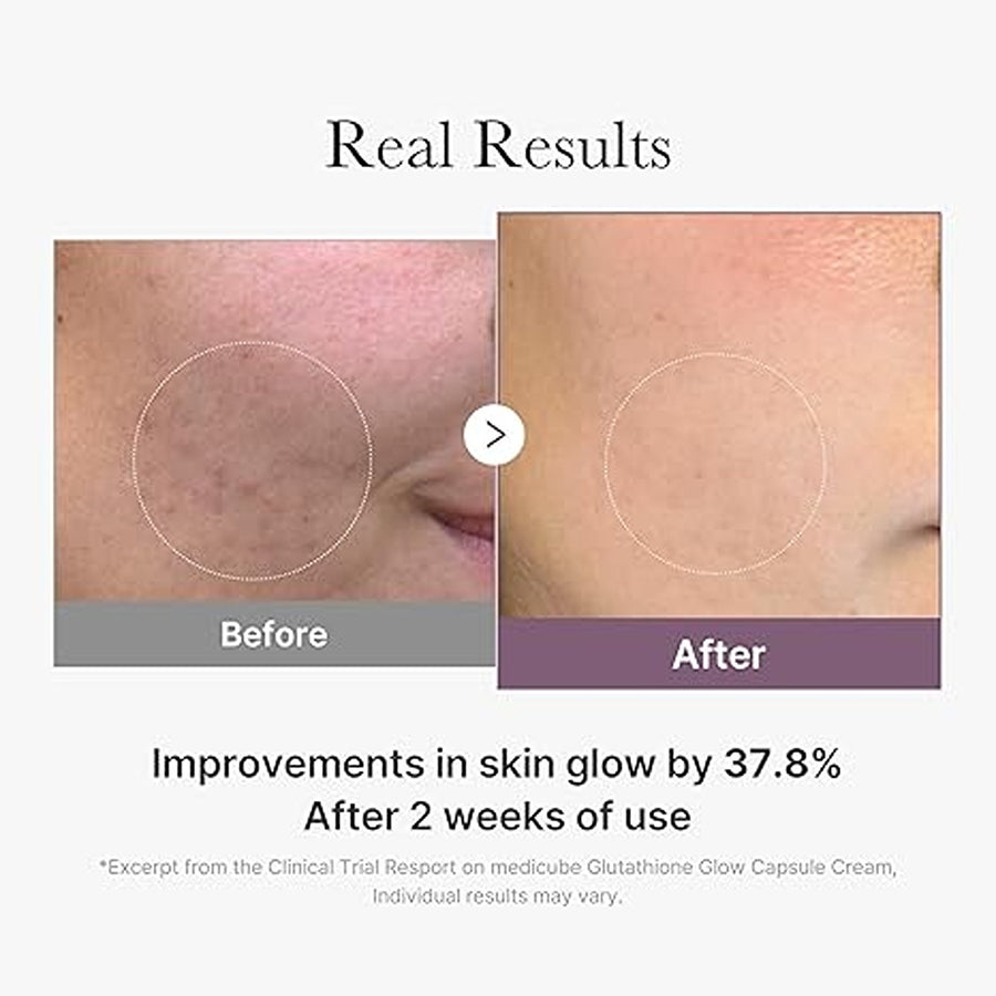 Age-r glutathione glow capsule facial cream 50ml