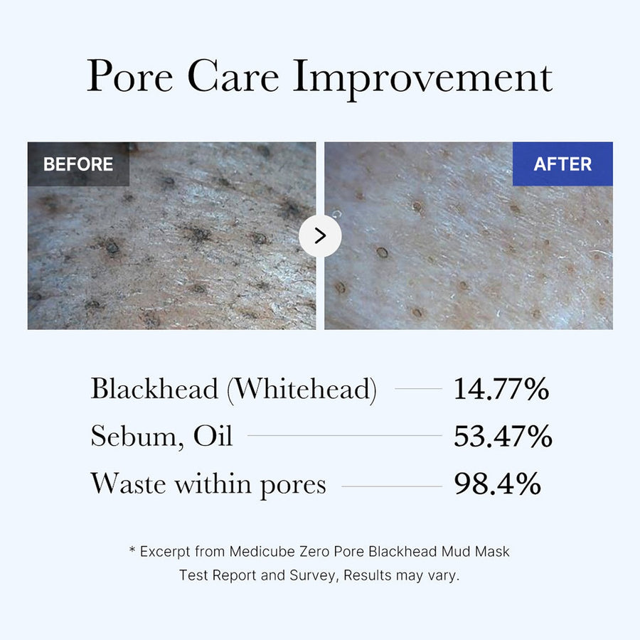 Zero pore blackhead mud mask