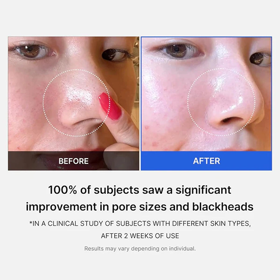 Zero pore pads 2.0, dual-textured facial toner pads