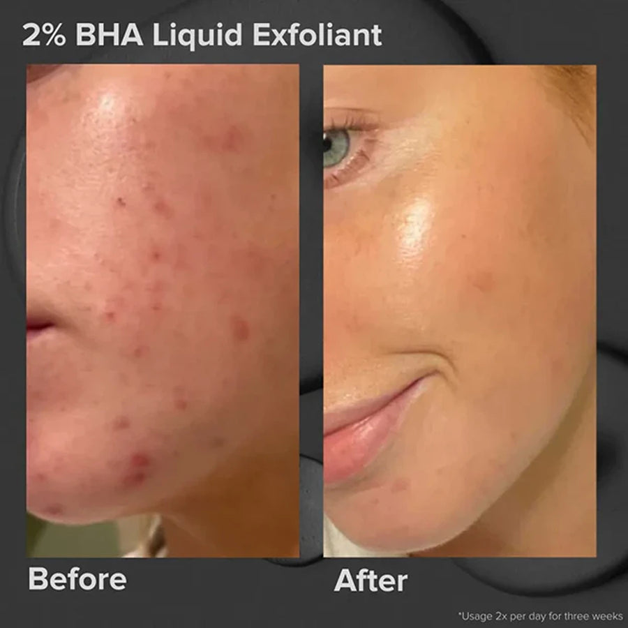 Multi-level exfoliation kit