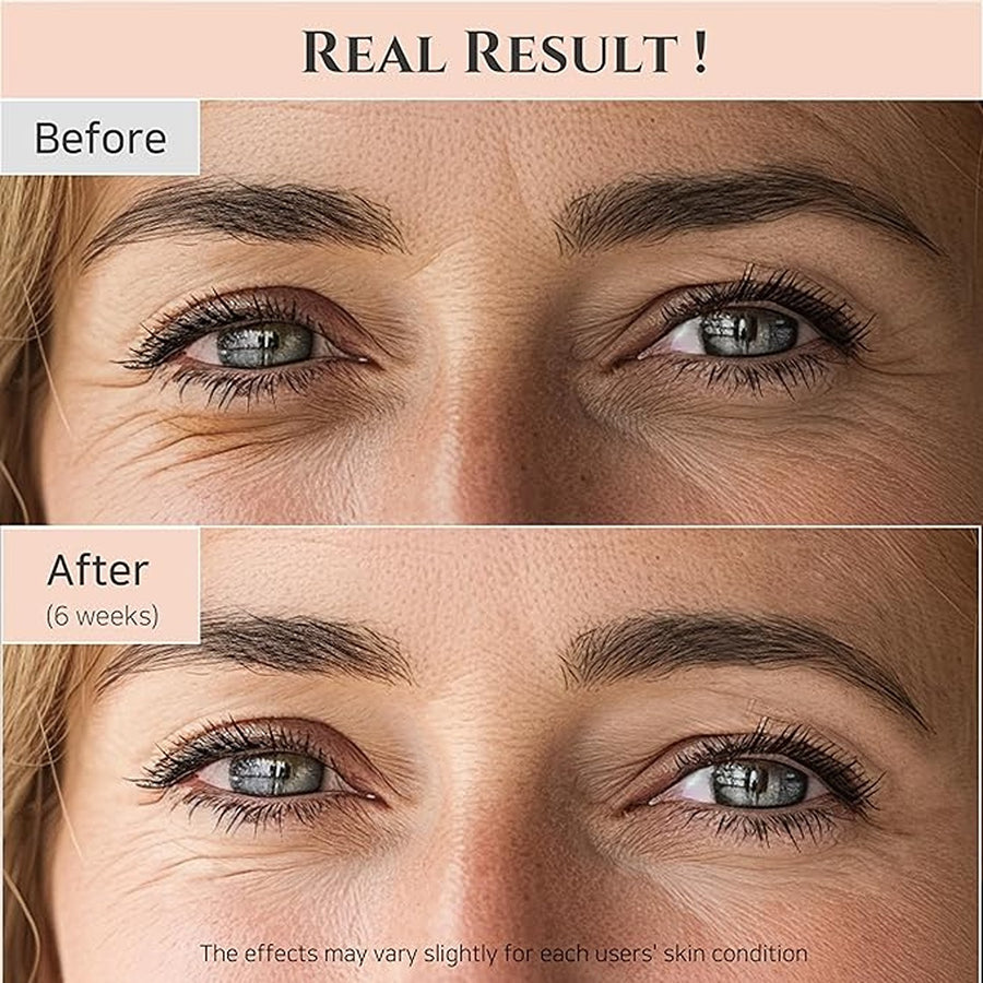 Revive eye serum with retinal niacinamide correction for puffy eye bags fine lines dark circles wrinkles, korean skin care 30ml, 1 fl.oz,