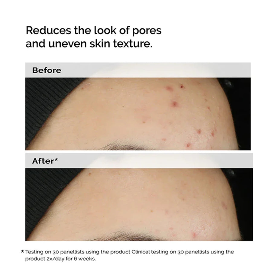 Balancing & clarifying serum for blemish-prone skin